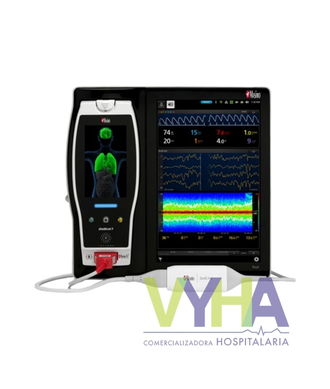 sedline monitor de función cerebral sedline monitor de función cerebral